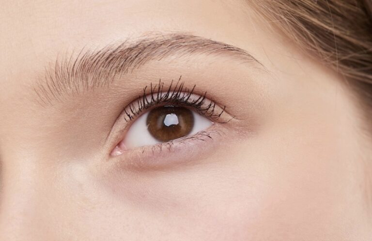 augenbrauenlifting-brow-lift-768x498